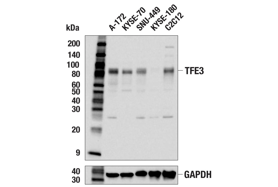 Western Blotting Image 3: TFE3 (E6T9M) Rabbit mAb