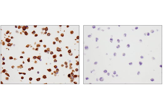 Immunohistochemistry Image 3: SMAD4 (D3R4N) XP<sup>®</sup> Rabbit mAb