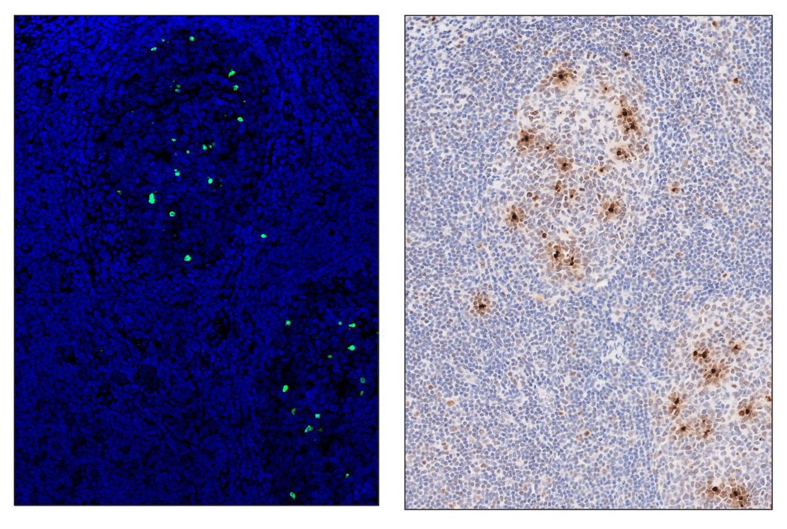Immunohistochemistry Image 6: Phospho-Histone H2A.X (Ser139) (D7T2V) & CO-0135-647 SignalStar<sup>™</sup> Oligo-Antibody Pair