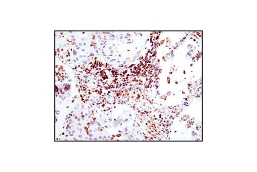 Immunohistochemistry Image 1: HS1 (D83A8) XP<sup>®</sup> Rabbit mAb (BSA and Azide Free)