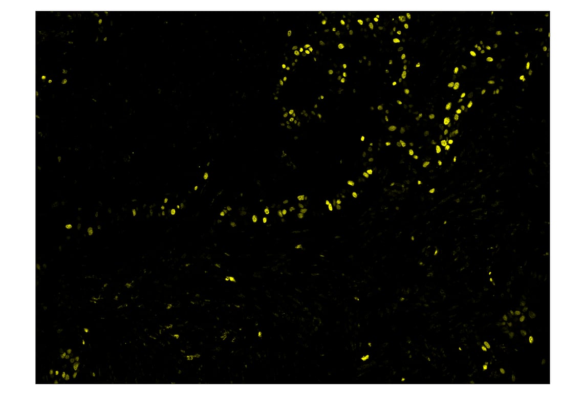 Immunohistochemistry Image 3: Ki-67 (8D5) & CO-0014-647 SignalStar<sup>™</sup> Oligo-Antibody Pair