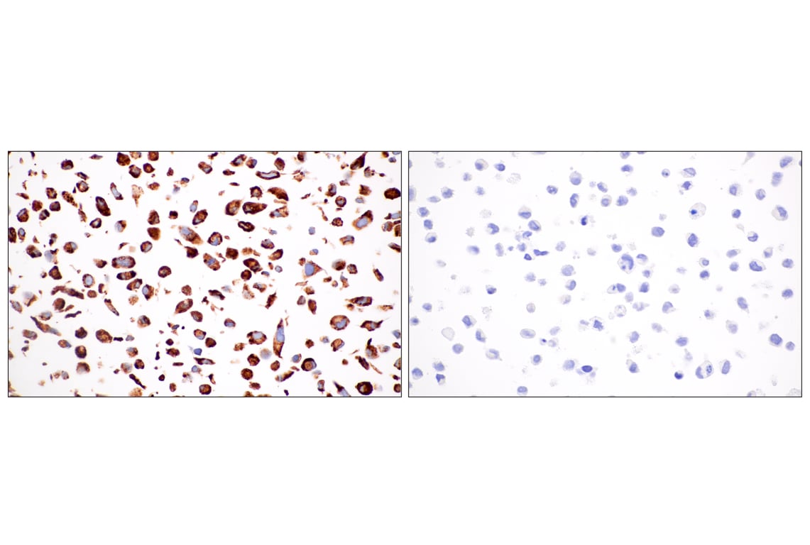 Immunohistochemistry Image 7: HSP47/SERPINH1 (E4A8P) Rabbit mAb