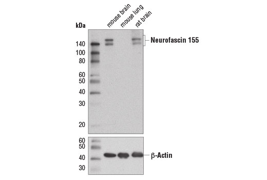 undefined Image 2: Demyelinating Disease Targets Antibody Sampler Kit