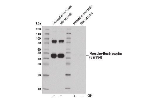 Western Blotting Image 1: Phospho-Doublecortin (Ser334) (D11B10) Rabbit mAb
