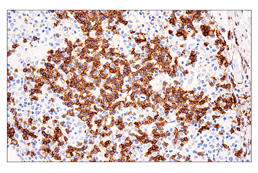 Immunohistochemistry Image 4: CD20 (E7B7T) XP<sup>®</sup> Rabbit mAb