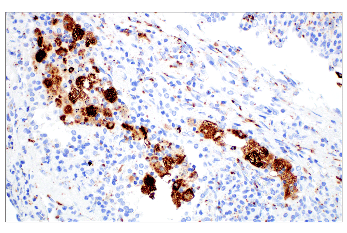 Immunohistochemistry Image 1: Perilipin-2 (E6G6M) Rabbit mAb