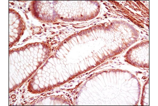 Immunohistochemistry Image 1: Pan-Actin (D18C11) Rabbit mAb