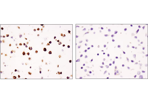 undefined Image 61: Human Exhausted CD8<sup>+</sup> T Cell IHC Antibody Sampler Kit