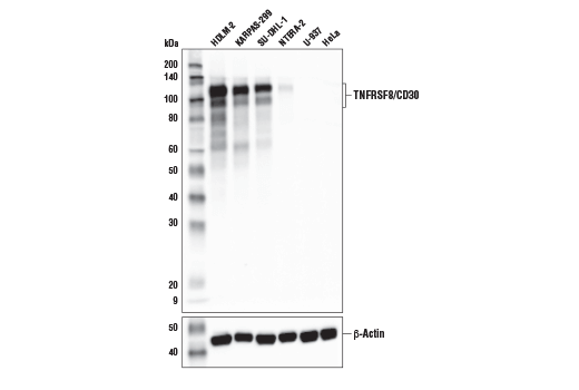 Western Blotting Image 2: TNFRSF8/CD30 (E7E4D) XP<sup>®</sup> Rabbit mAb