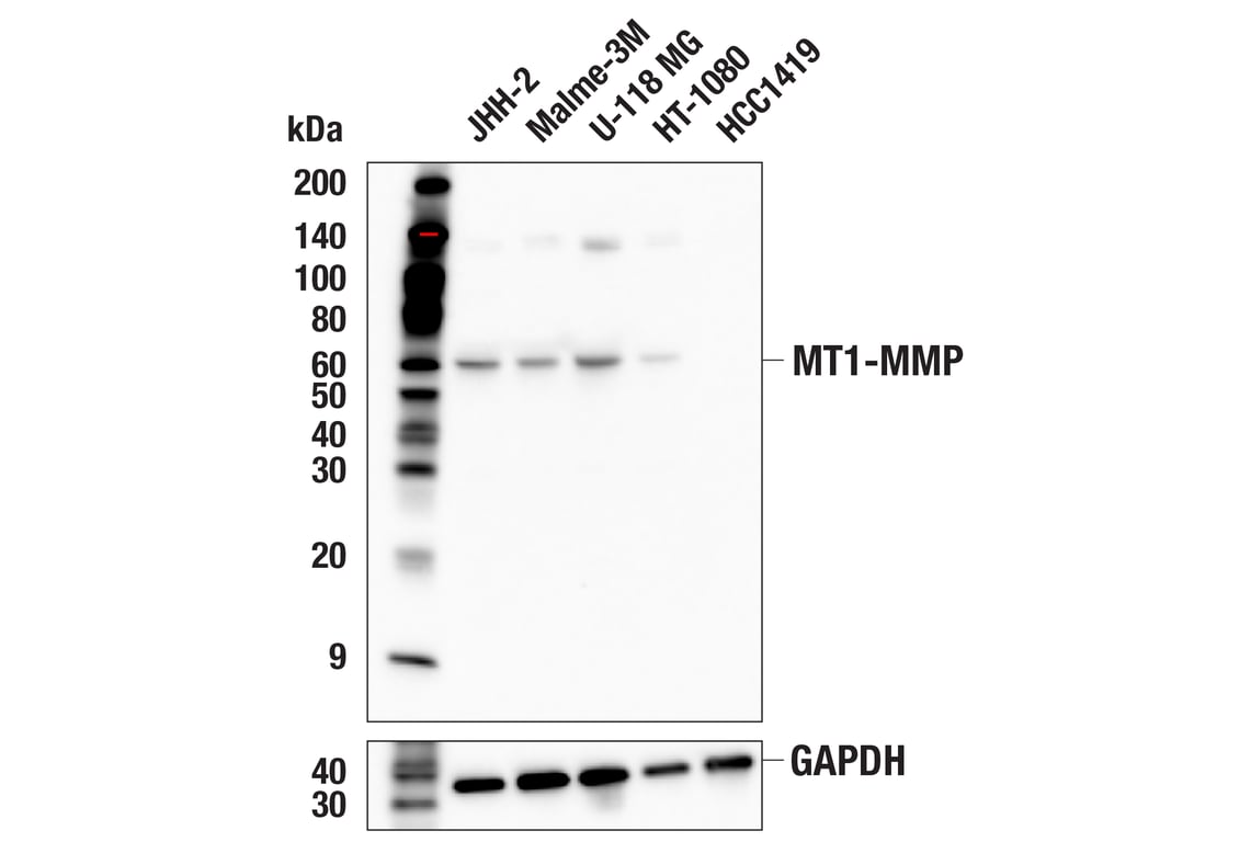 Western Blotting Image 1: MT1-MMP (E3S5S) Rabbit mAb