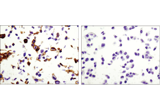 undefined Image 15: Tight Junction Antibody Sampler Kit