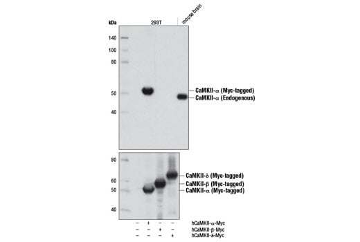 Western Blotting Image 1: CaMKII-α (D10C11) Rabbit mAb