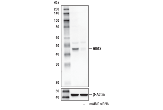 undefined Image 20: Mouse Reactive Inflammasome Antibody Sampler Kit
