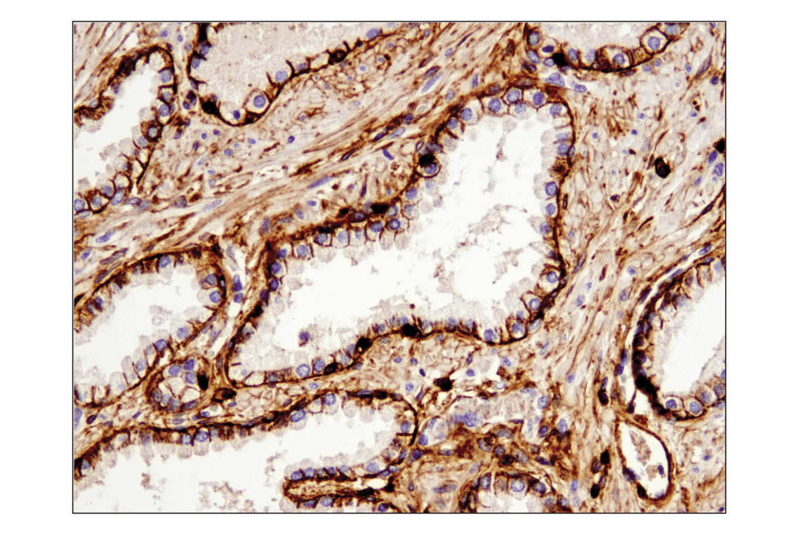 Immunohistochemistry Image 2: CD44 (E7K2Y) XP<sup>®</sup> Rabbit mAb (BSA and Azide Free)