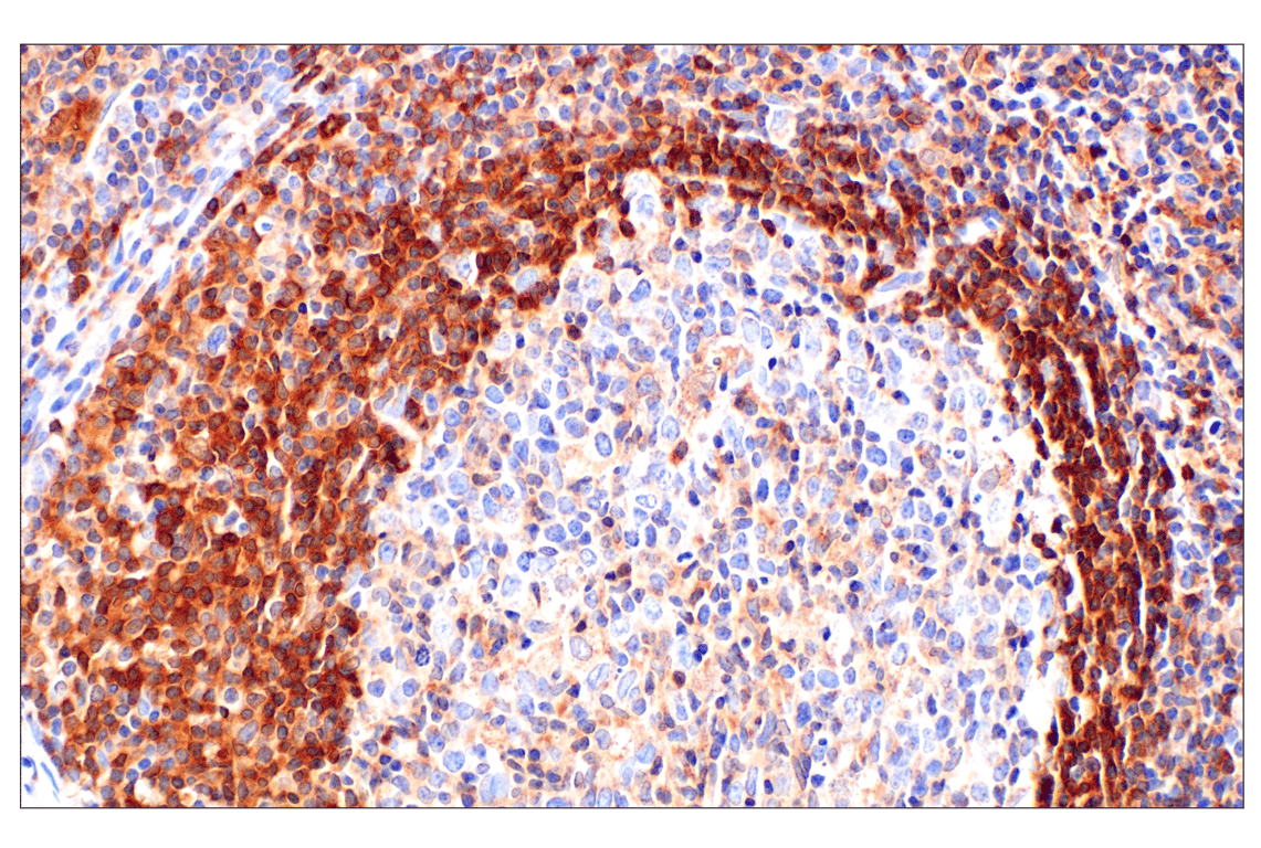 Immunohistochemistry Image 4: Catalase (D4P7B) XP<sup>®</sup> Rabbit mAb