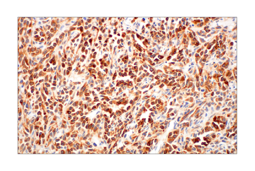 undefined Image 29: Pro-Apoptosis Bcl-2 Family Antibody Sampler Kit II