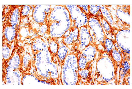 Immunohistochemistry Image 1: COL1A1 (E8F4L) XP<sup>®</sup> Rabbit mAb (BSA and Azide Free)