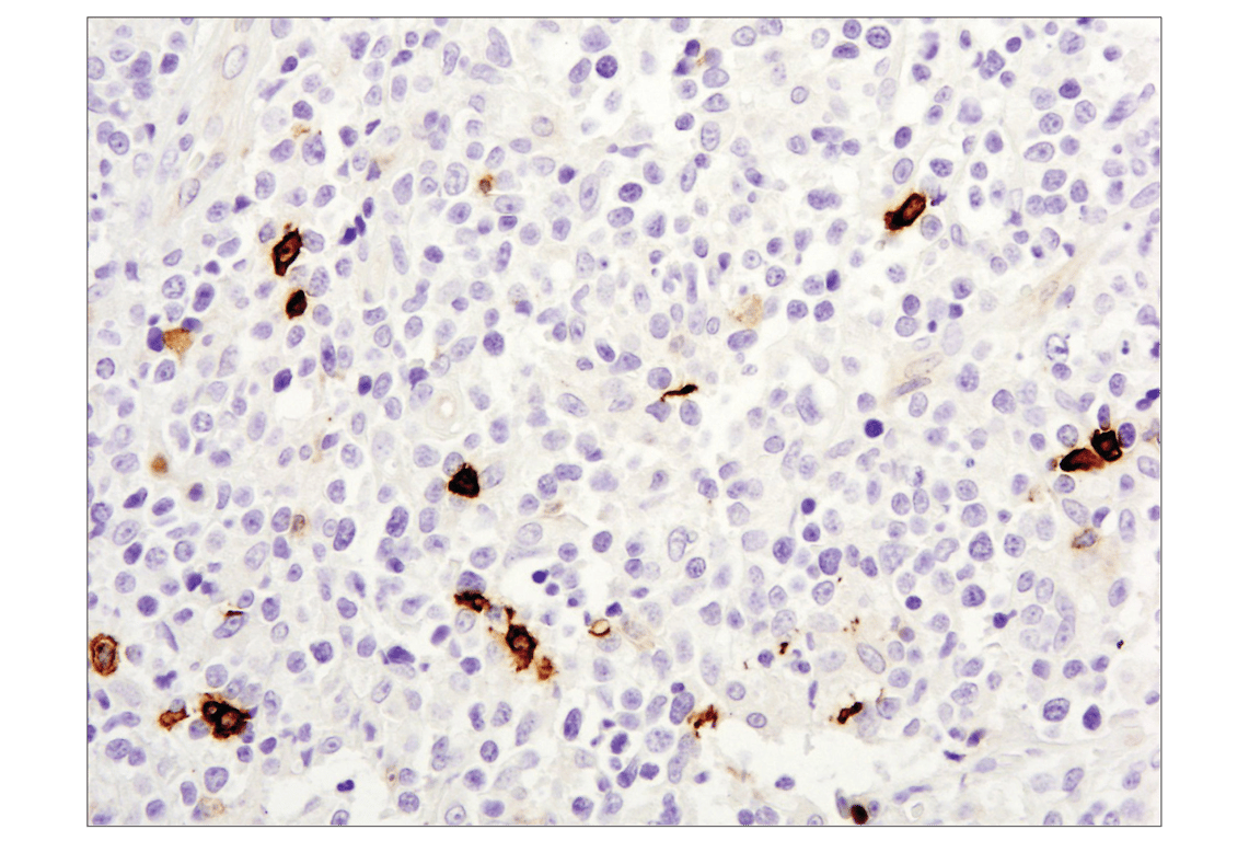 Immunohistochemistry Image 4: OX40 (E9U7O) XP<sup>®</sup> Rabbit mAb (BSA and Azide Free)