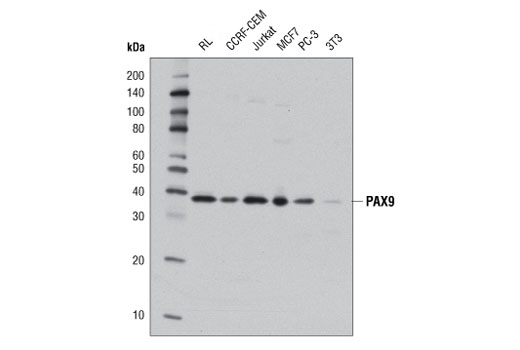 Western Blotting Image 1: PAX9 (D9F1N) Rabbit mAb