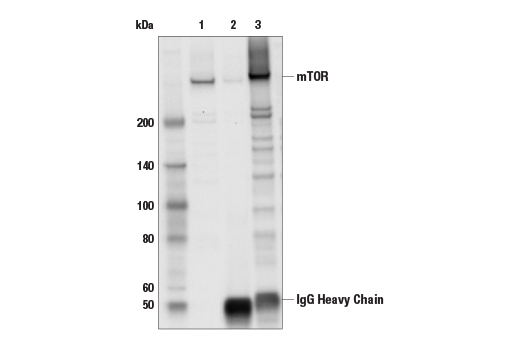 undefined Image 3: TREM2-dependent mTOR Metabolic Fitness Antibody Sampler Kit