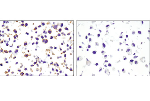 Immunohistochemistry Image 3: Non-phospho (Active) β-Catenin (Ser45) (D2U8Y) XP<sup>®</sup> Rabbit mAb (BSA and Azide Free)