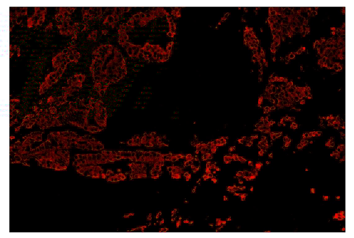Immunohistochemistry Image 4: Pan-Keratin (Type I) (E6S1S) & CO-0072-594 SignalStar<sup>™</sup> Oligo-Antibody Pair