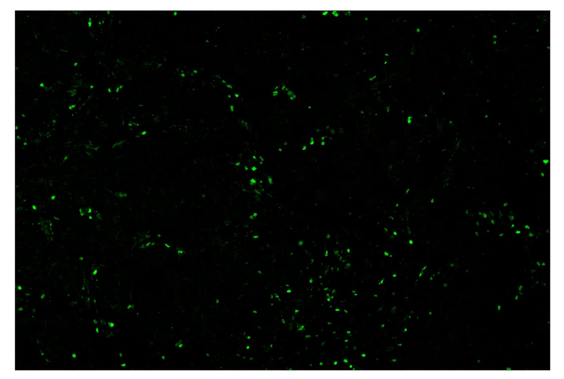 Immunohistochemistry Image 2: Tox/Tox2 (E6I3Q) & CO-0016-750 SignalStar<sup>™</sup> Oligo-Antibody Pair