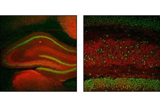 Immunofluorescence Image 1: α/β-Synuclein (Syn205) Mouse mAb