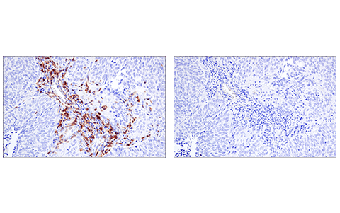 Immunohistochemistry Image 3: LAT (E3U6J) XP<sup>®</sup> Rabbit mAb (BSA and Azide Free)