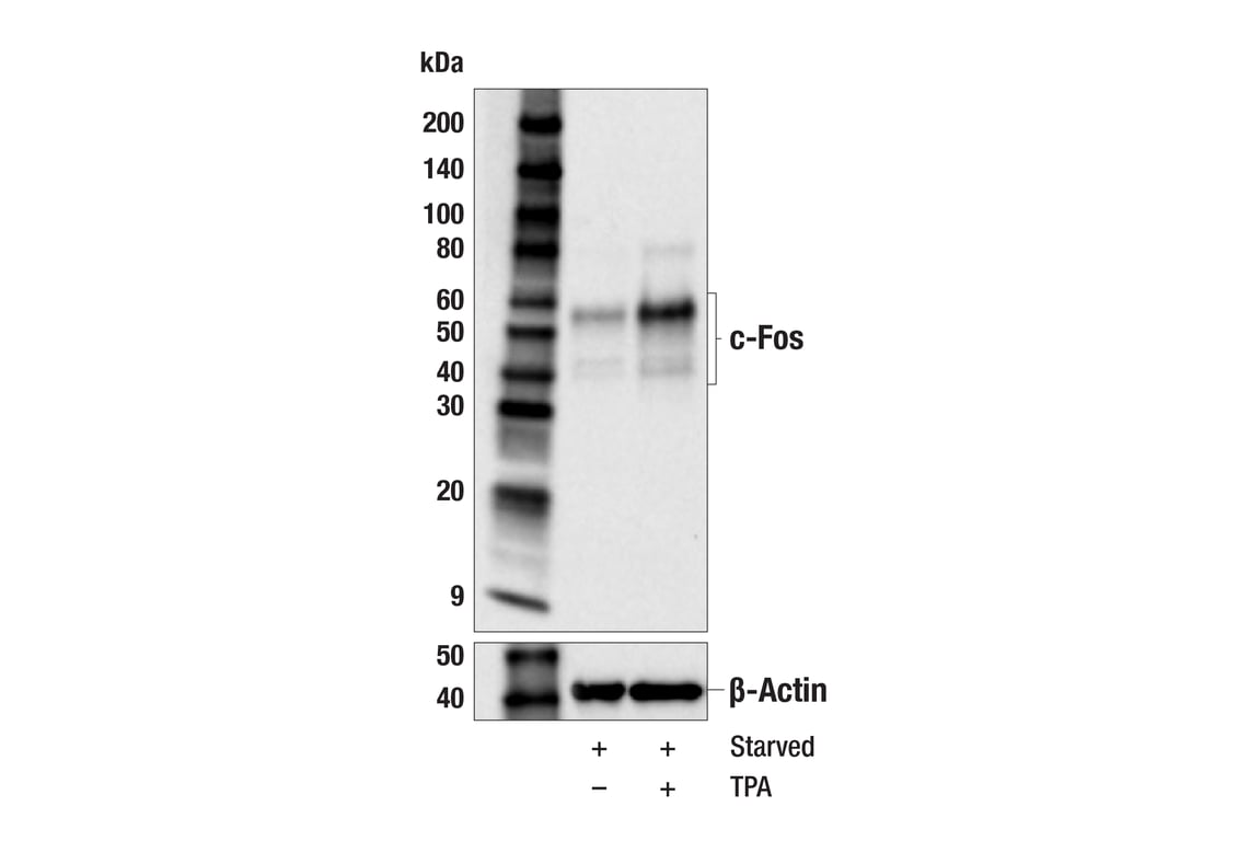 Western Blotting Image 2: c-Fos (E2I7R) XP<sup>®</sup> Rabbit mAb