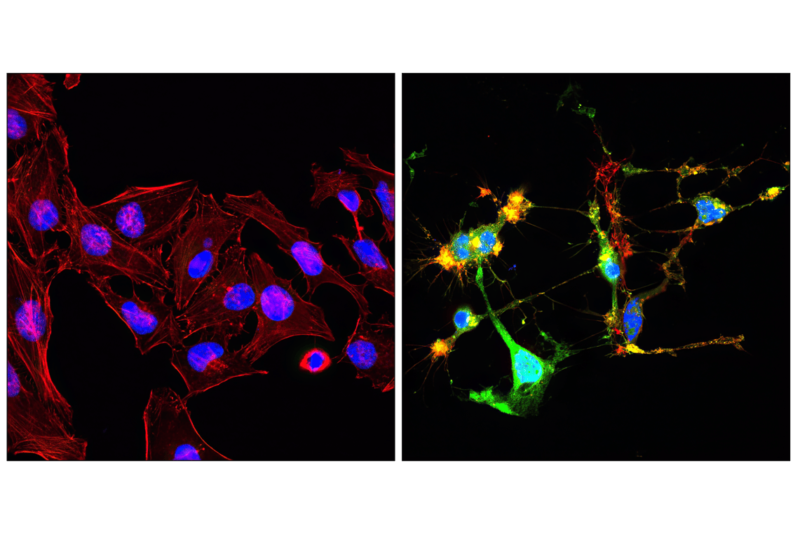 Immunofluorescence Image 1: Cleaved Caspase-3 (Asp175) (D3E9) Rabbit mAb (Alexa Fluor<sup>®</sup> 488 Conjugate)