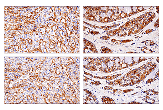 Immunohistochemistry Image 5: APP (E8B3O) XP<sup>®</sup> Rabbit mAb