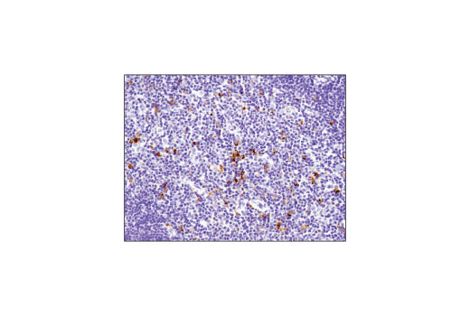 Immunohistochemistry Image 3: TIM-3 (D3M9R) XP<sup>®</sup> Rabbit mAb