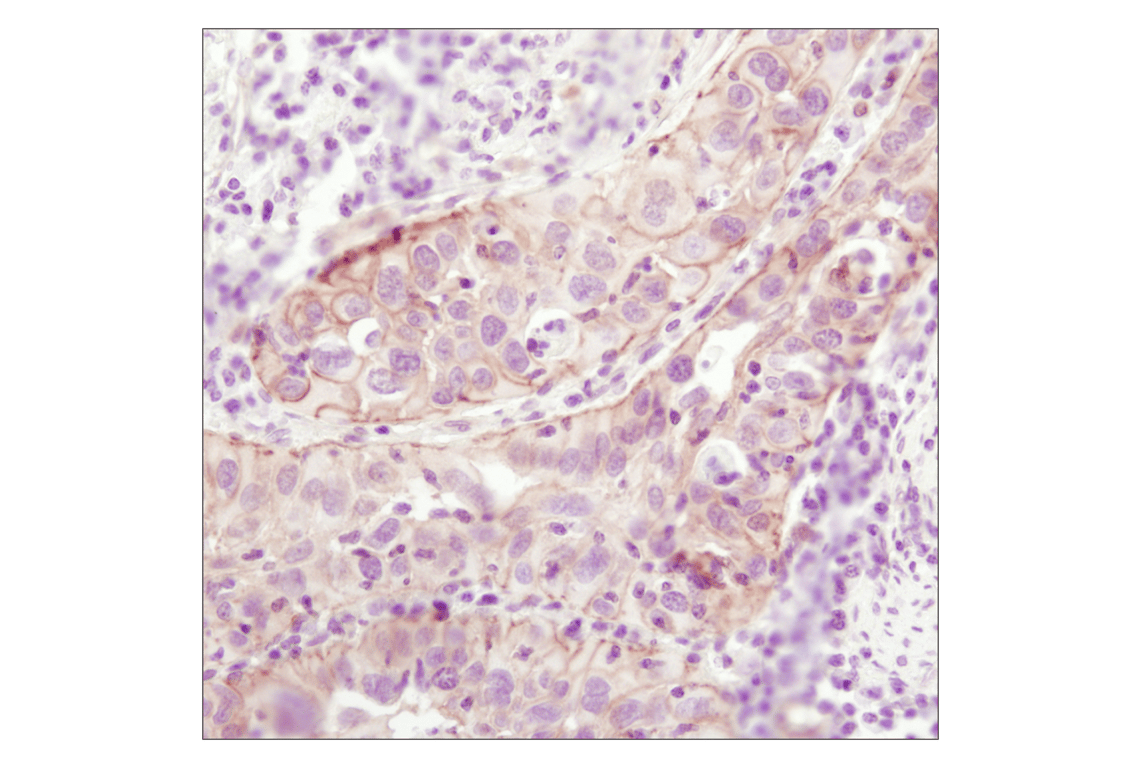Immunohistochemistry Image 2: β-Catenin (6B3) Rabbit mAb