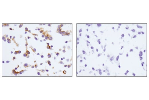 Immunohistochemistry Image 7: EpCAM (E6V8Y) XP<sup>®</sup> Rabbit mAb (BSA and Azide Free)