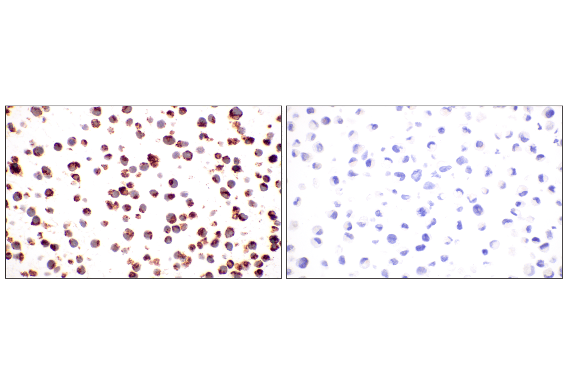 Immunohistochemistry Image 11: NKG7 (F4V5I) Rabbit mAb (BSA and Azide Free)