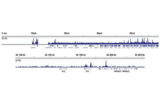 undefined Image 66: BAF Complex IHC Antibody Sampler Kit