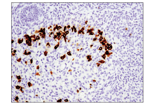 Immunohistochemistry Image 5: PD-1 (Intracellular Domain) (D7D5W) XP<sup>®</sup> Rabbit mAb