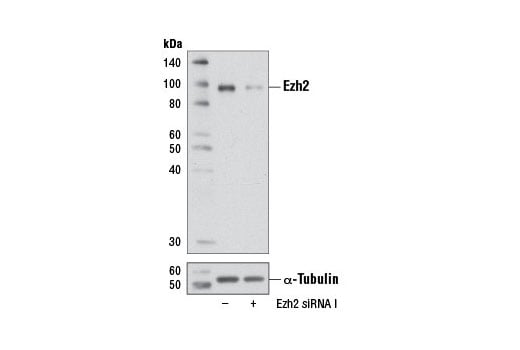 undefined Image 1: SignalSilence<sup>®</sup> Ezh2 siRNA I