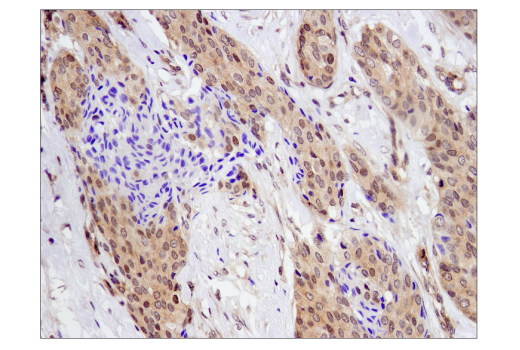 Immunohistochemistry Image 3: SMAD4 (D3R4N) XP<sup>®</sup> Rabbit mAb (BSA and Azide Free)