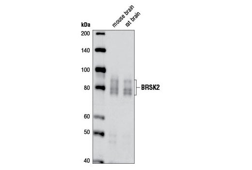 Western Blotting Image 1: BRSK2 (D29B6) Rabbit mAb