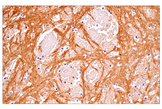 Immunohistochemistry Image 6: α-Synuclein (E4U2F) XP<sup>®</sup> Rabbit mAb (BSA and Azide Free)