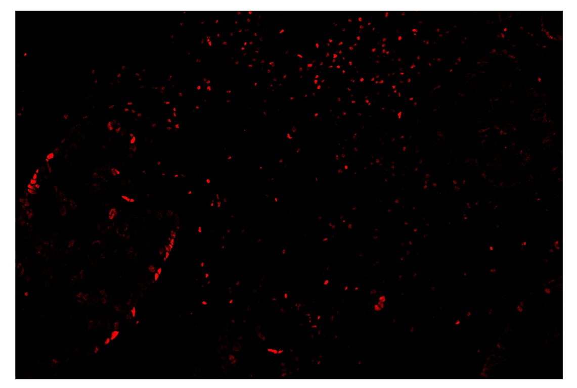 Immunohistochemistry Image 4: TCF1/TCF7 (C63D9) & CO-0006-594 SignalStar<sup>™</sup> Oligo-Antibody Pair