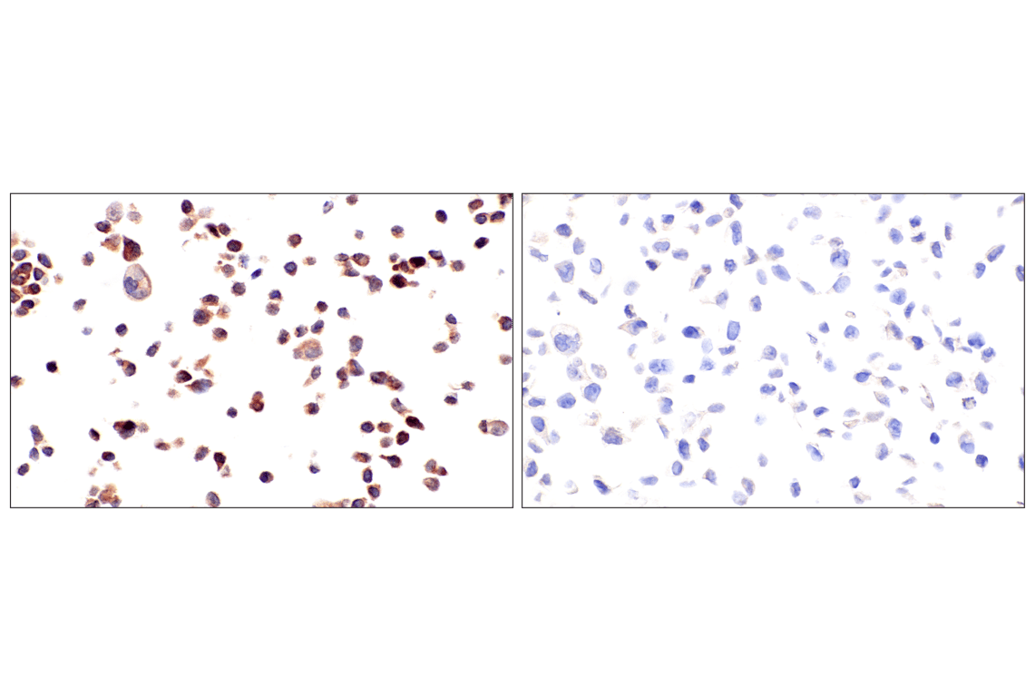 Immunohistochemistry Image 14: ADAR1 p150 Isoform (E6U1U) Rabbit mAb