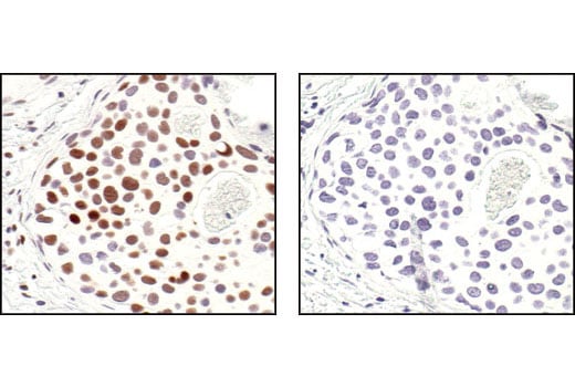 undefined Image 9: PhosphoPlus<sup>®</sup> CREB (Ser133) Antibody Duet