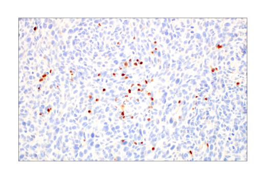 Immunohistochemistry Image 9: T-bet/TBX21 (E4I2K) Rabbit mAb