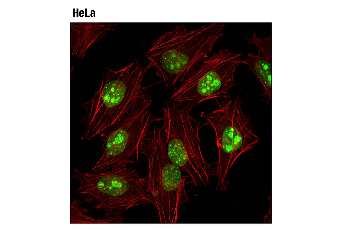 Immunofluorescence Image 1: Ki-67 (D3B5) Rabbit mAb (Alexa Fluor<sup>®</sup> 488 Conjugate)