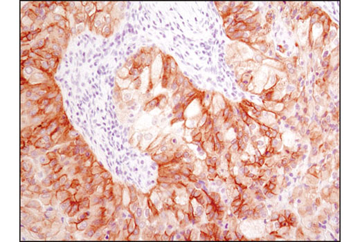 Immunohistochemistry Image 2: Met (D1C2) XP<sup>®</sup> Rabbit mAb (BSA and Azide Free)