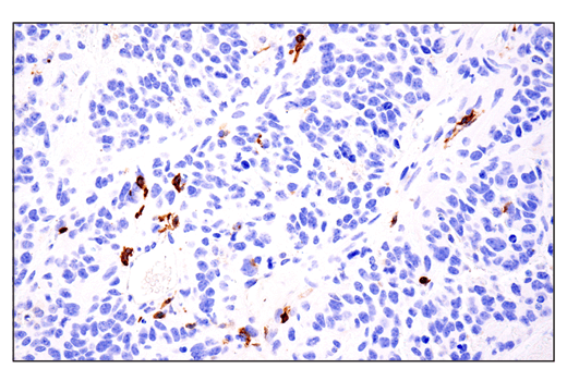 Immunohistochemistry Image 5: IL-2Rα/CD25 (E4B2Z) XP<sup>®</sup> Rabbit mAb (BSA and Azide Free)