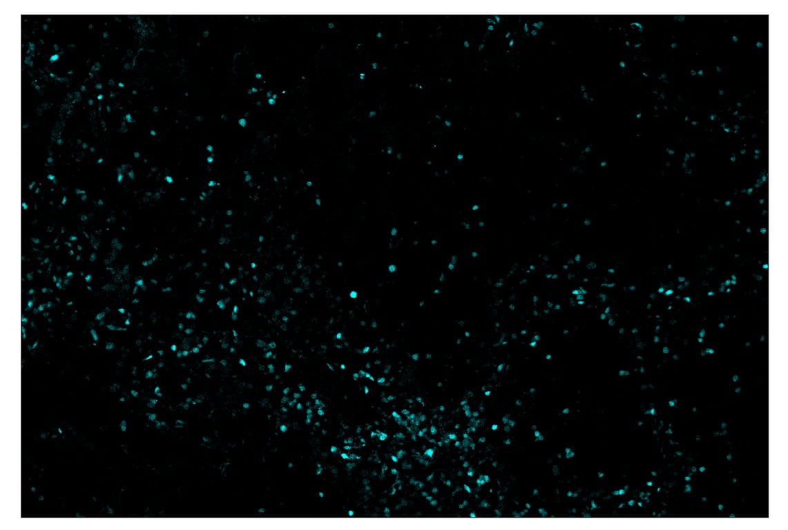 Immunohistochemistry Image 5: Tox/Tox2 (E6I3Q) & CO-0016-750 SignalStar<sup>™</sup> Oligo-Antibody Pair